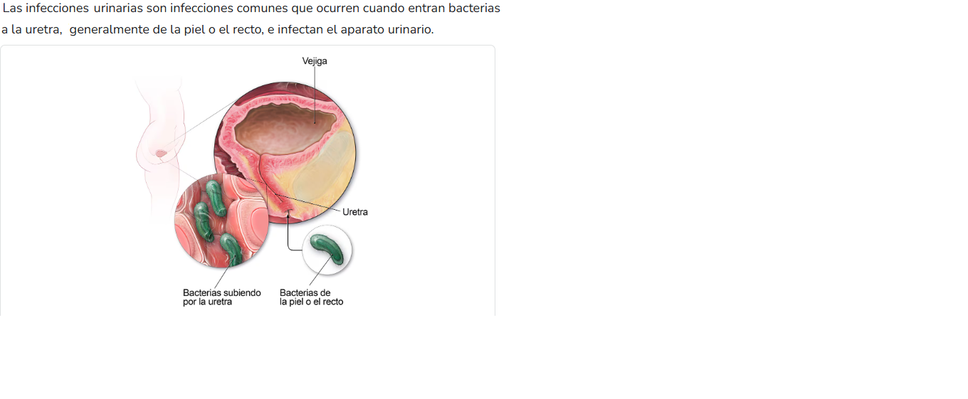 Unidad 2: Infecciones Urinarias